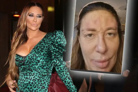 ЛИЦЕТО НА АНА НИКОЛИЌ ВО РАНИ, А МАЈКА ѝ грми ВО БИКИНИ! Вака изгледа мајката  Миљана во седмата деценија, вистинска БОМБА (ФОТО)