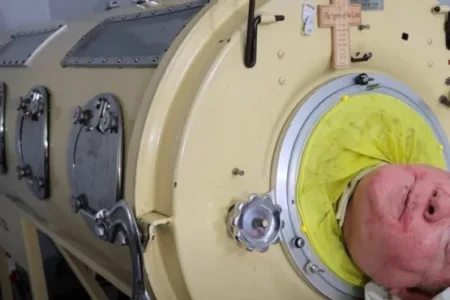 Почина човекот кој 70 години живееше со железни бели дробови! Остана парализиран како дете: Ова е неговата тажна приказна