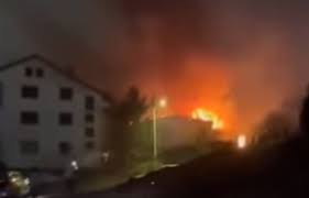 Во Градска хоспитализирани 27 лица со тешни изгореници, 24 на Клинички, 18 во „8 Септември“